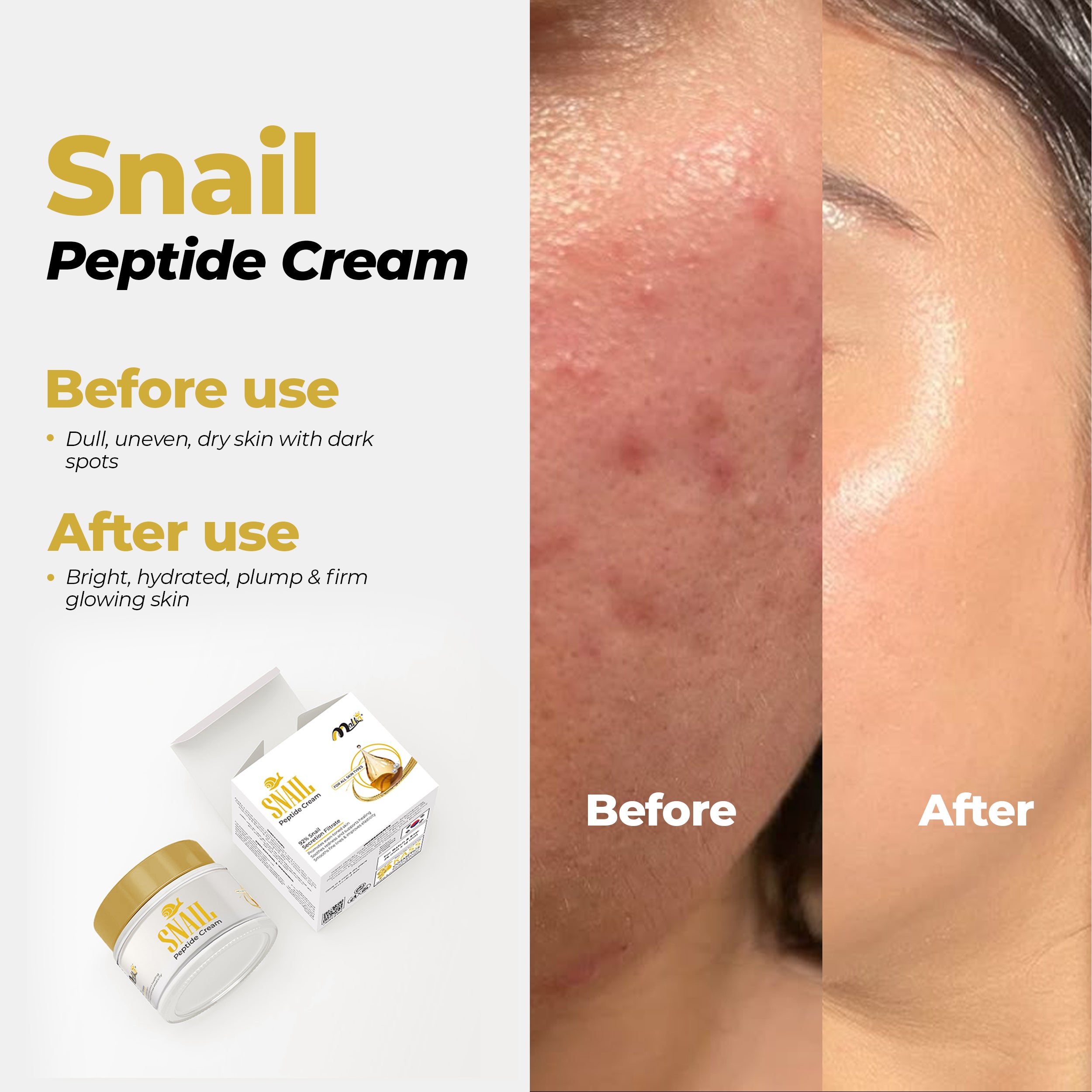 Snail Peptide Cream - 92% Snail Secretion Filterate